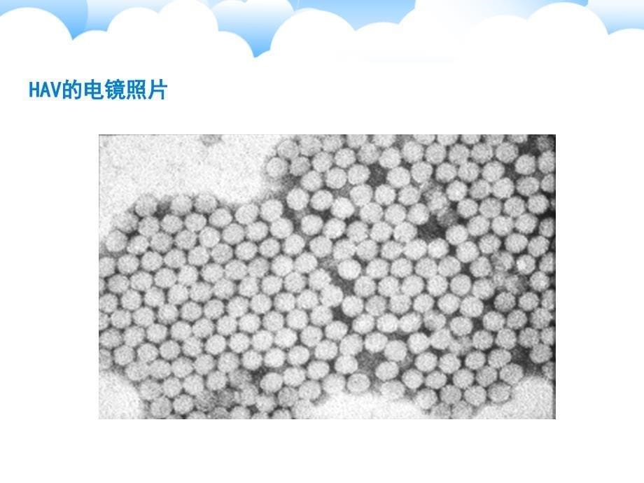 病毒性肝炎的分类你了解吗_第5页