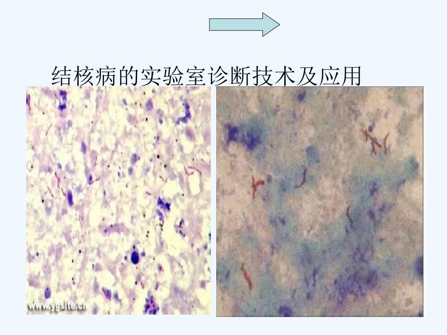 结核病的实验室诊断技术及应用_第4页