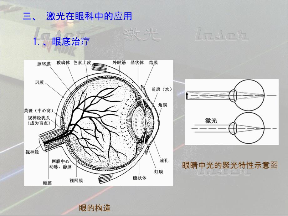 激光在医学中的应用资料_第4页