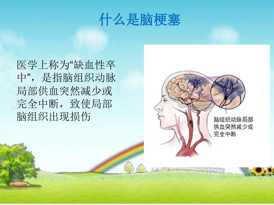 脑梗塞健康管理_第3页