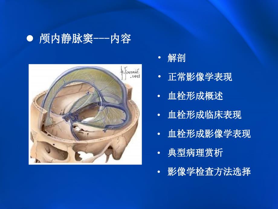 颅内静脉窦血栓形成的影像学表现_第2页