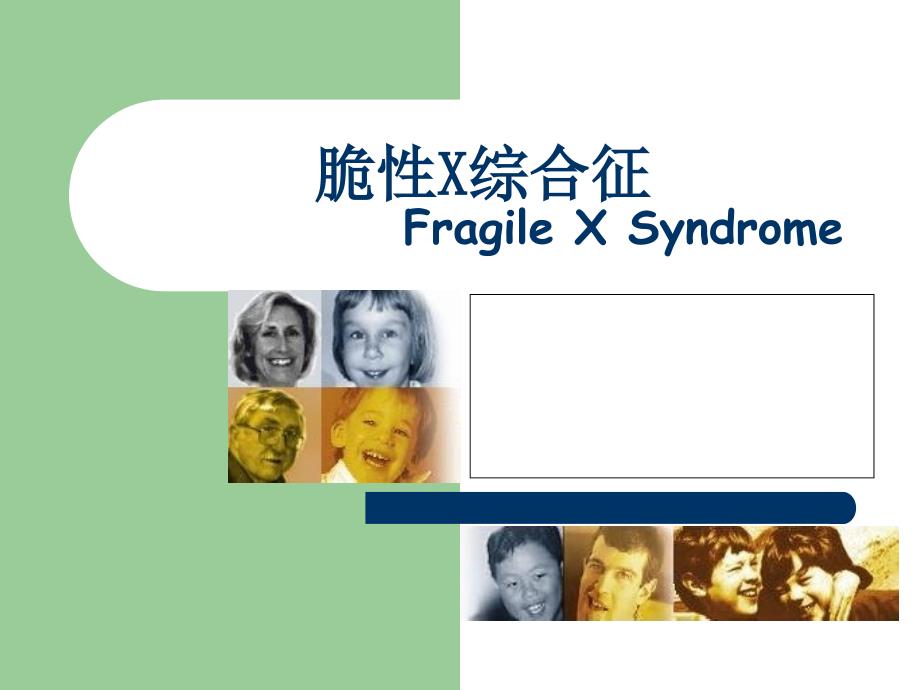 《脆性X综合征》PPT课件_第1页