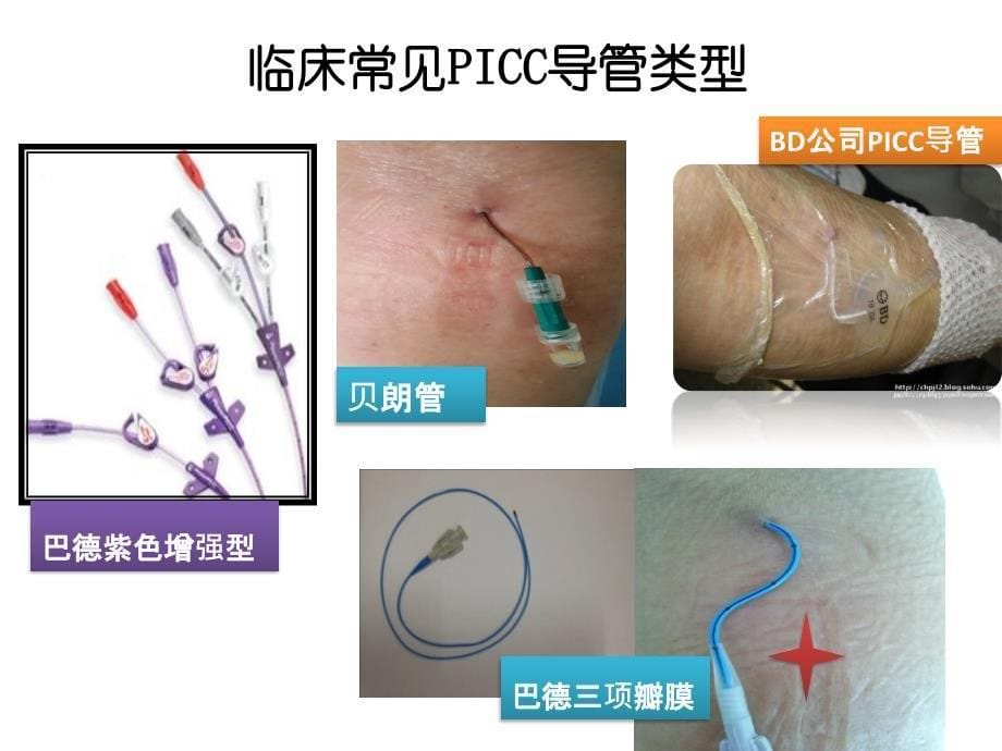 PICC维护常见问题及_护理_第5页