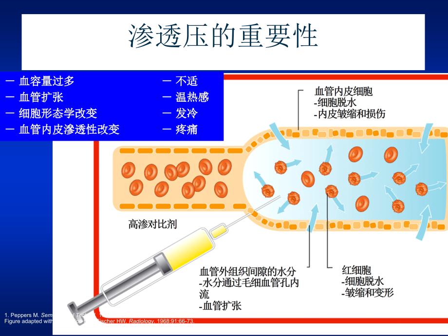 不同对比剂造影剂特点及应用选择_第4页