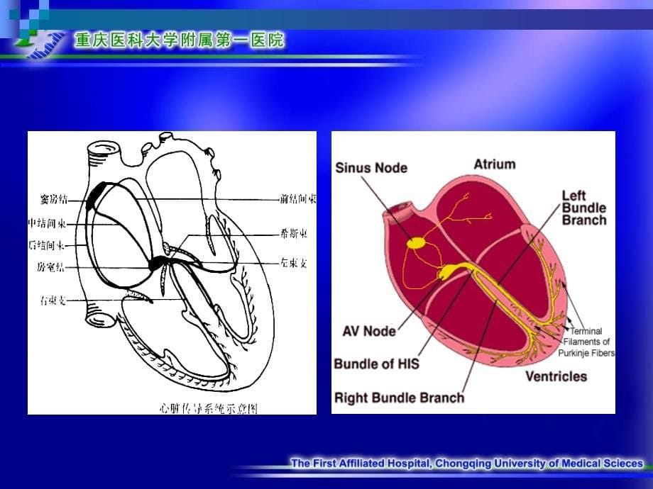 心律失常讲稿内科学课件_第5页