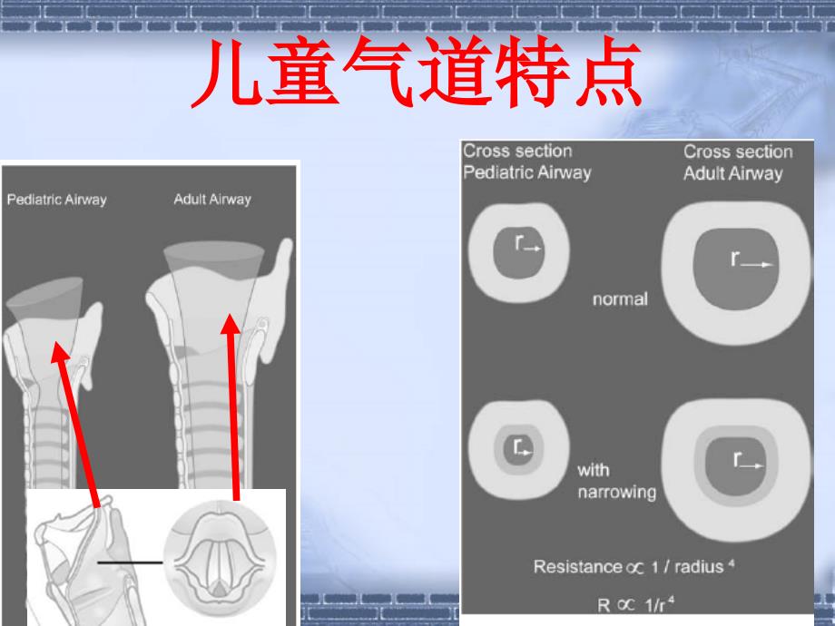 高级气道管理_第2页