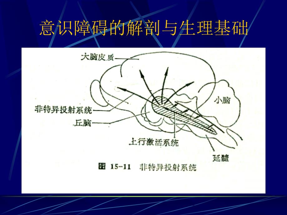 意识障碍教学课件_第3页