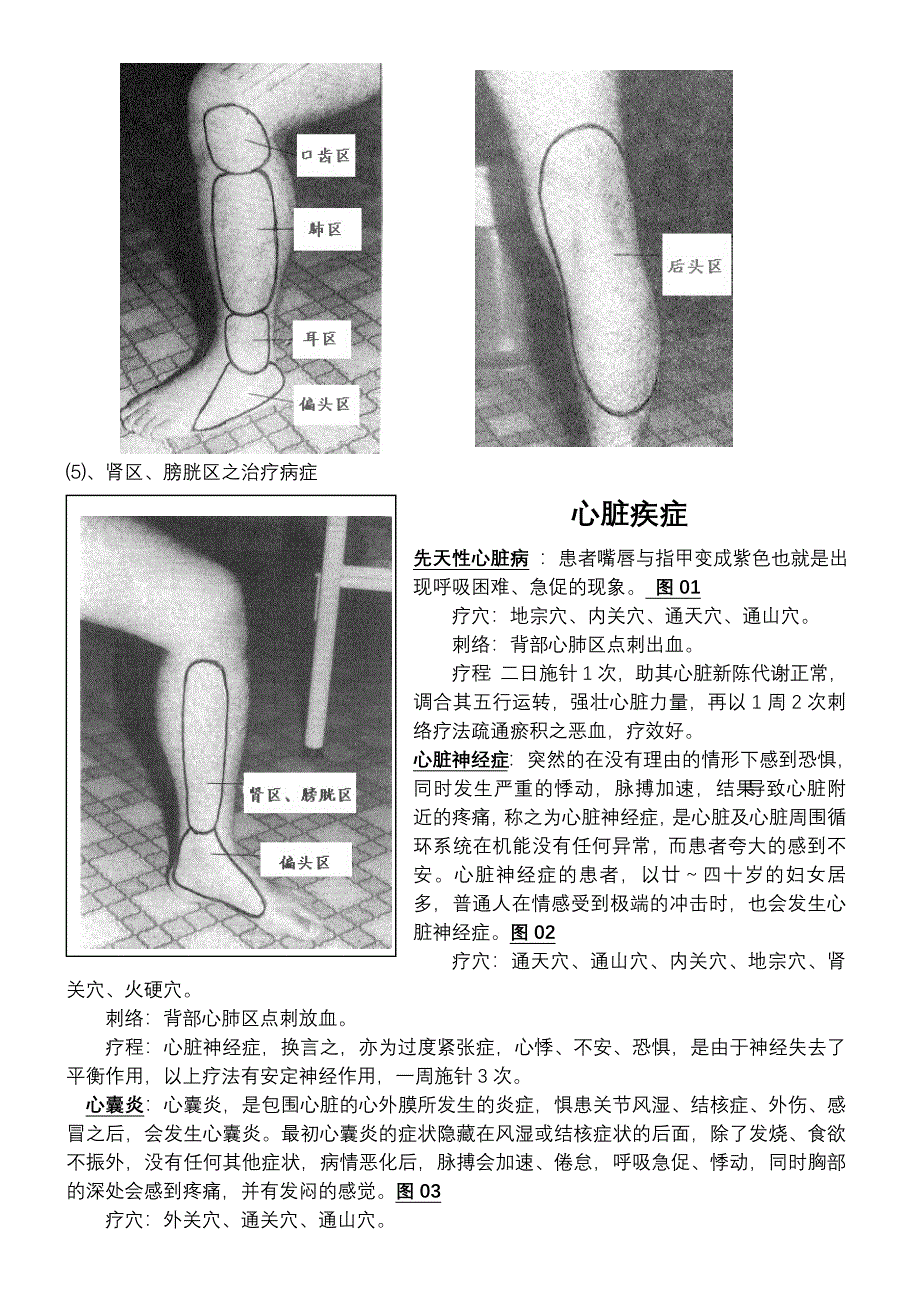 董氏针灸全集验证.doc_第4页