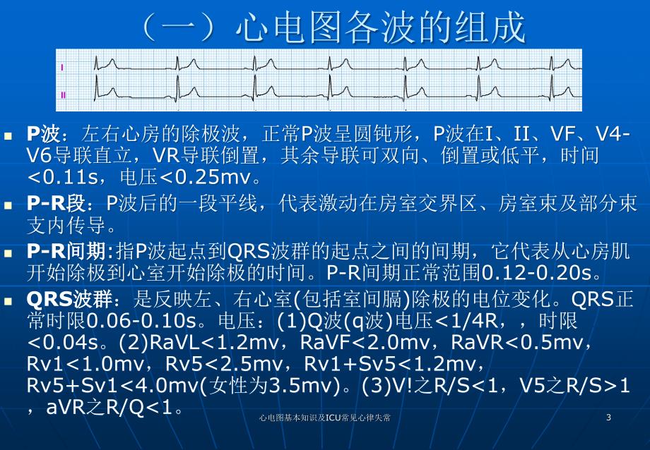 心电图基本知识及ICU常见心律失常ppt课件_第3页