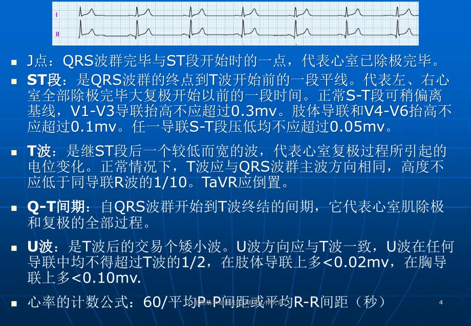 心电图基本知识及ICU常见心律失常ppt课件_第4页