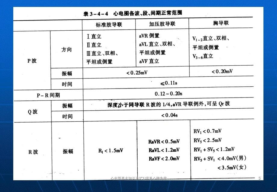 心电图基本知识及ICU常见心律失常ppt课件_第5页