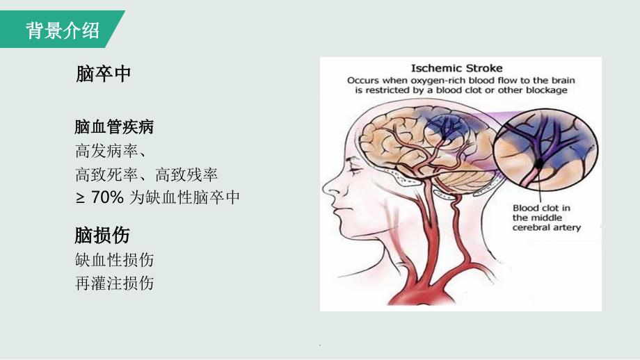 缺血性脑卒中治疗药物ppt课件_第4页