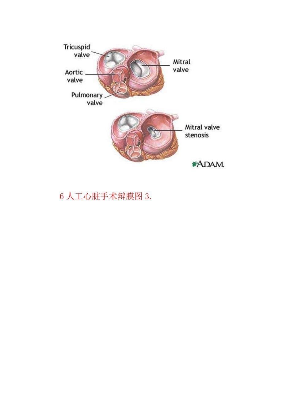 傻瓜系列 血液循环系统图集.doc_第5页