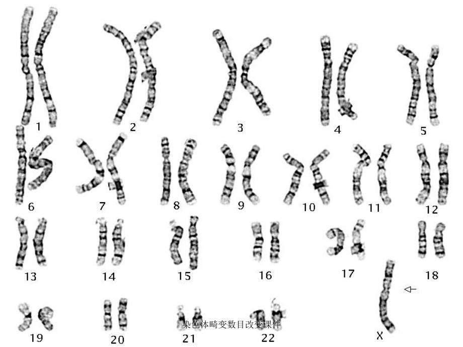 染色体畸变数目改变课件_第4页