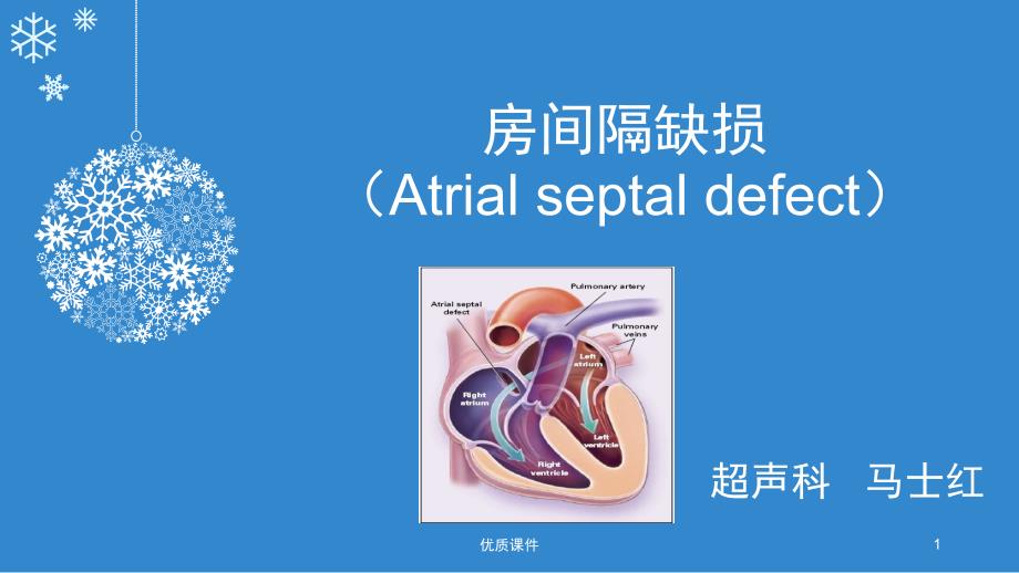 房间隔缺损PPT[优质严选]_第1页