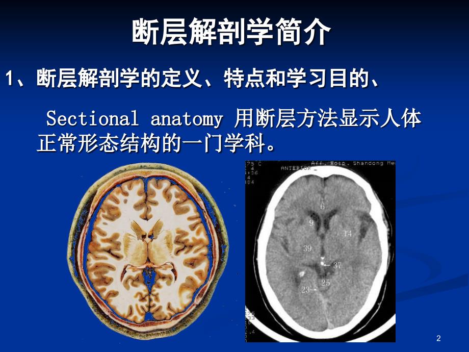 CT解剖学简介ppt参考课件_第2页