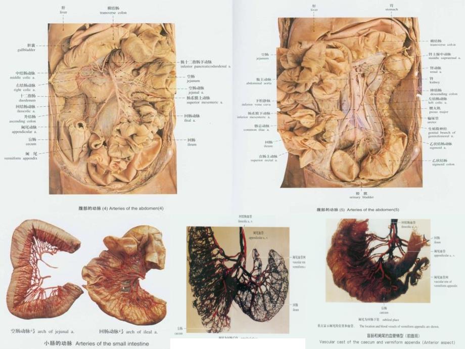 动脉2-人体解剖学教学.ppt_第3页