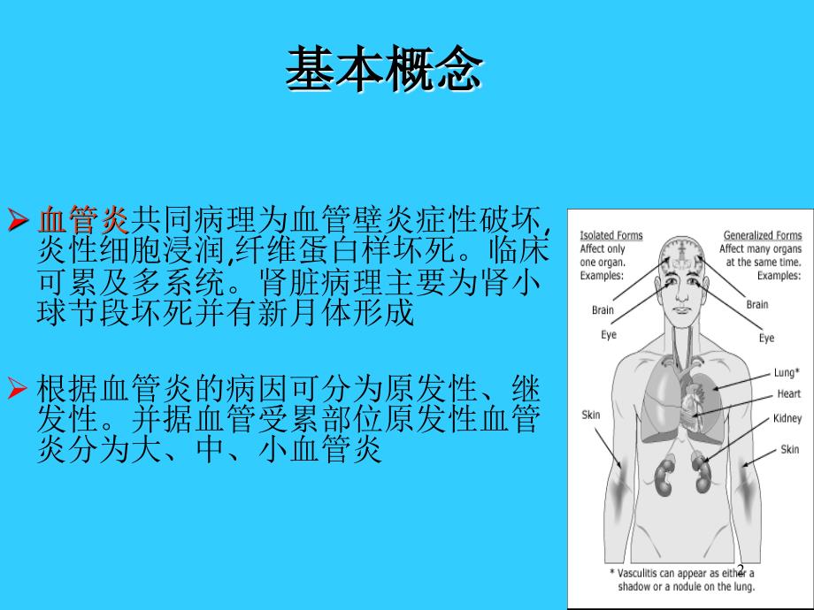 原发性血管炎ppt课件_第2页