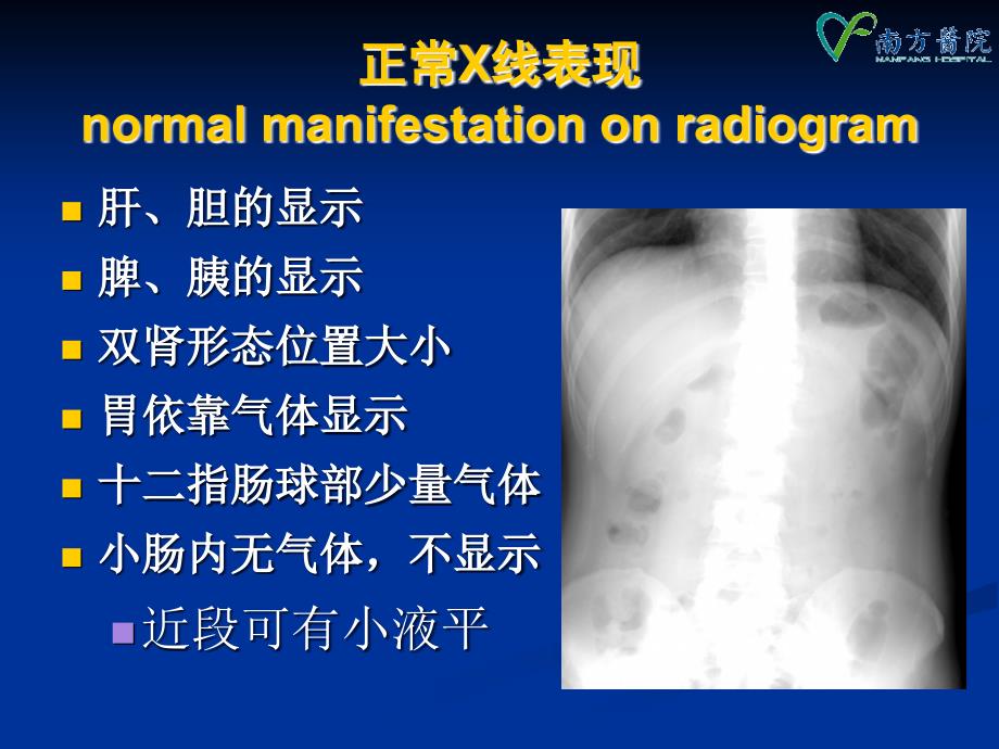 急腹症影像学1PP课件_第4页