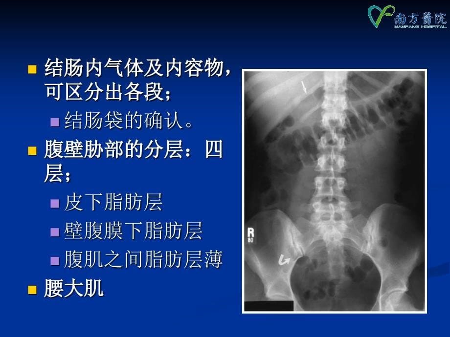 急腹症影像学1PP课件_第5页