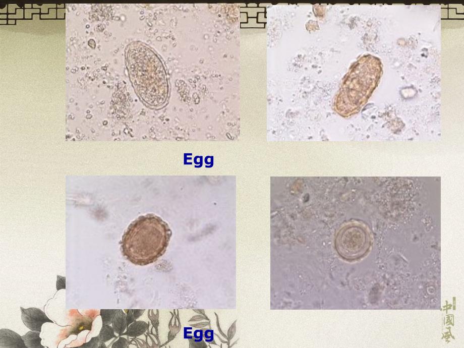 肠道寄生虫病.ppt_第3页