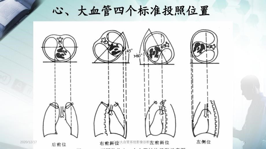 心与大血管系统影像诊断学精选PPT干货_第5页