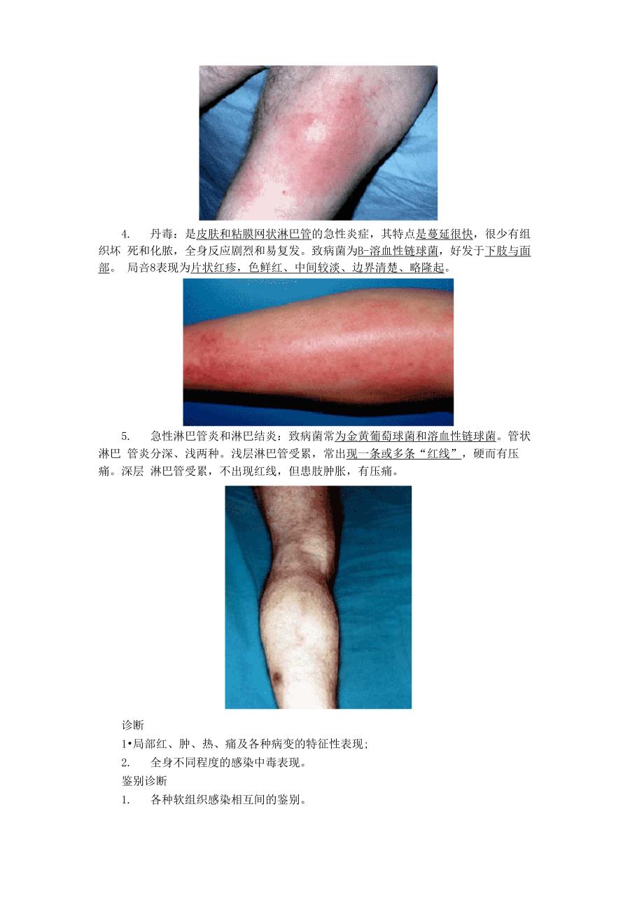 病例分析——软组织急性化脓性感染_第2页