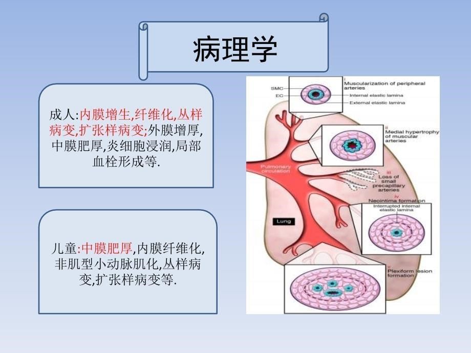 儿童与成人肺动脉高压特点比较_第5页