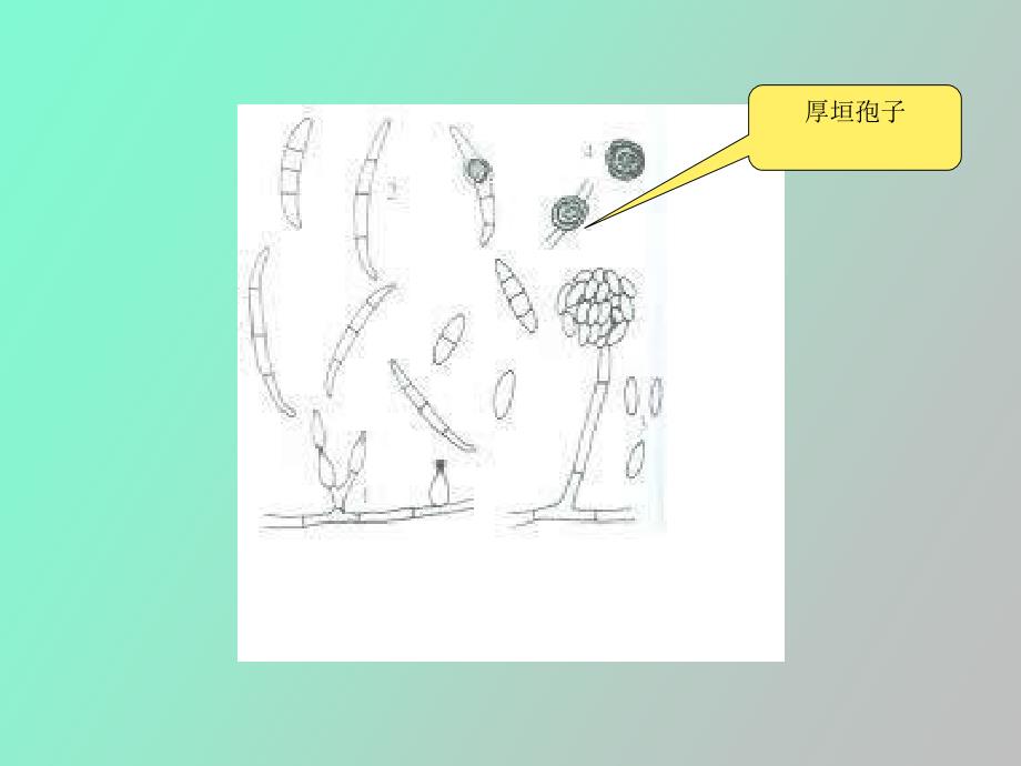 西瓜枯萎病及其防治措施_第4页