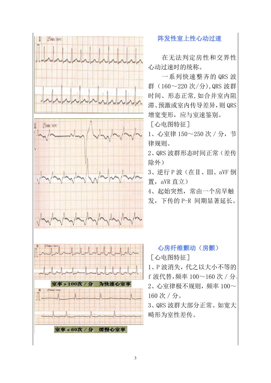 常见心电图诊断图谱.doc_第3页