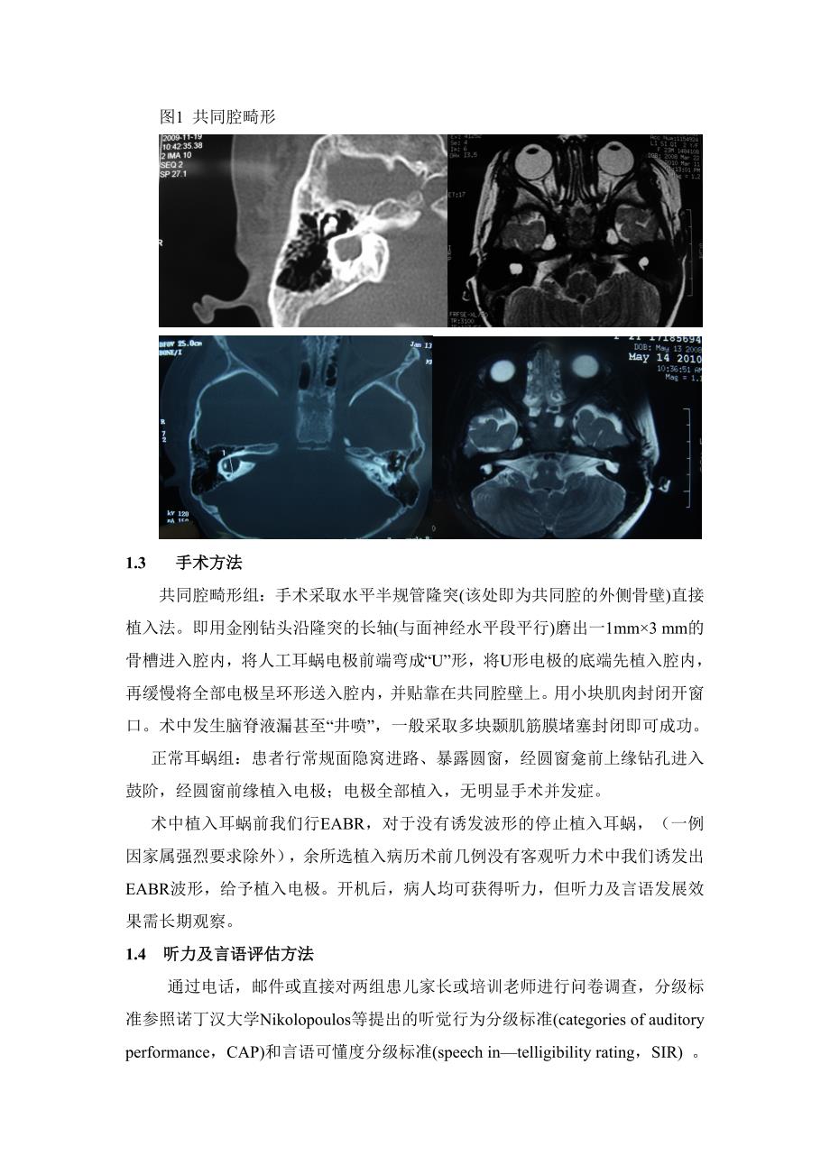 共同腔畸形患者人工耳蜗植入疗效评估2.docx_第3页