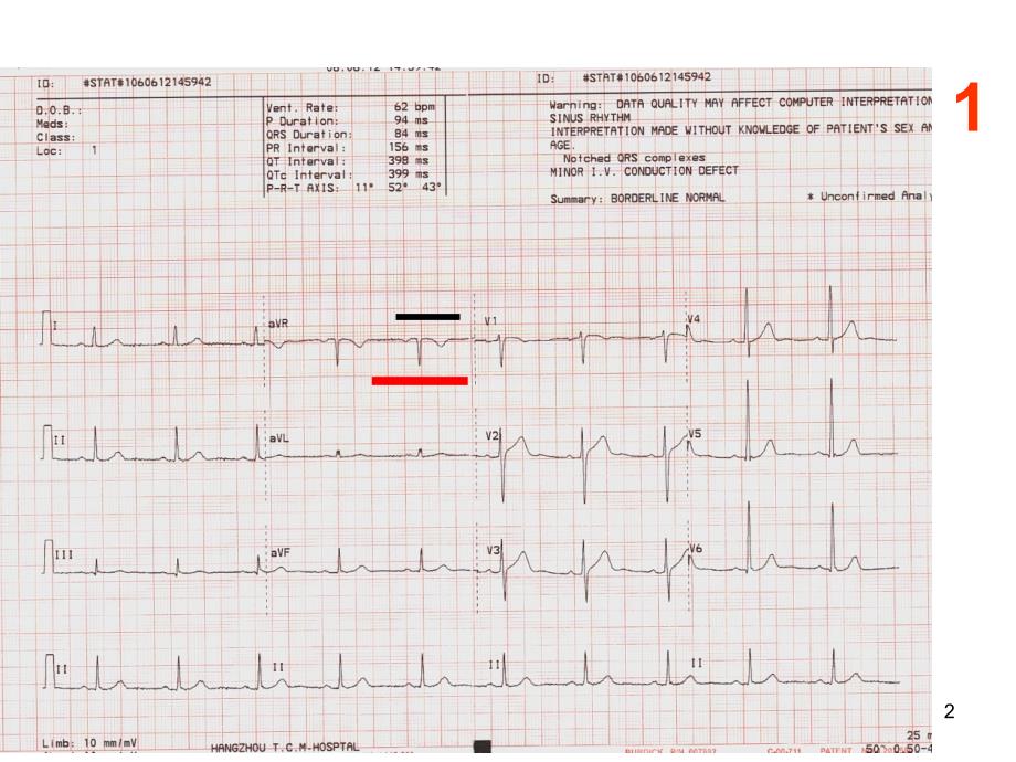 心电图考核图谱PPT课件_第2页