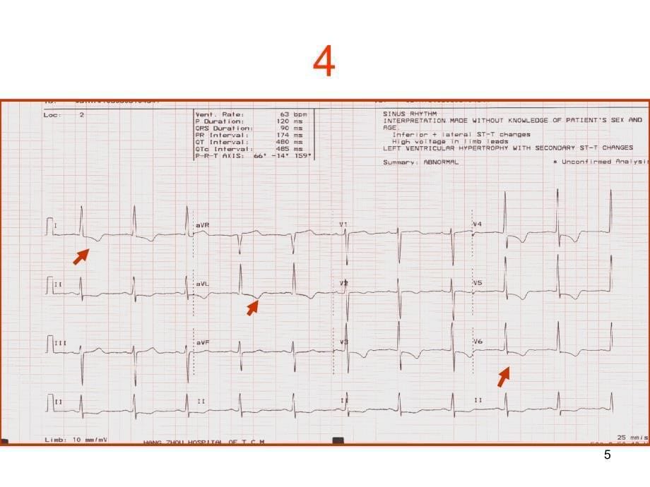 心电图考核图谱PPT课件_第5页