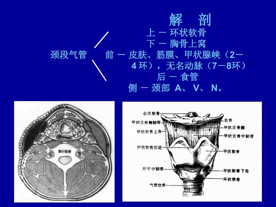 气管切开术PPT课件_第3页