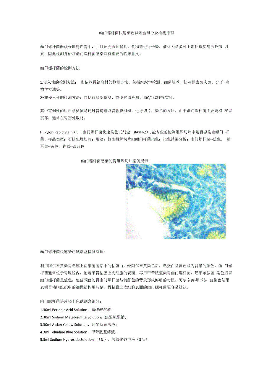 幽门螺杆菌快速染色试剂盒组分及检测原理_第1页