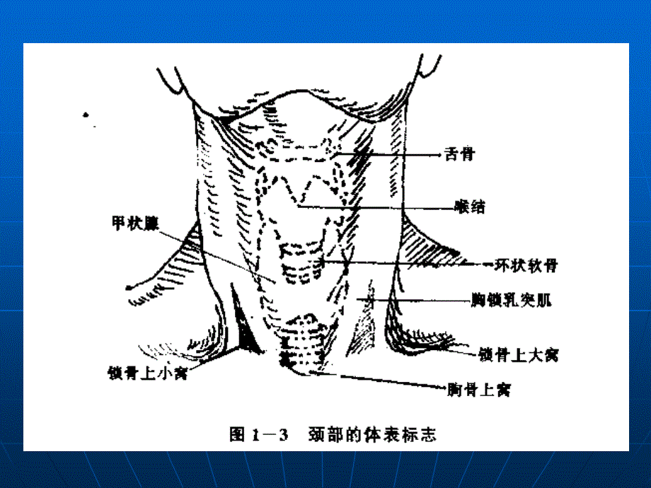 锁骨下静脉径路的技巧.ppt_第3页