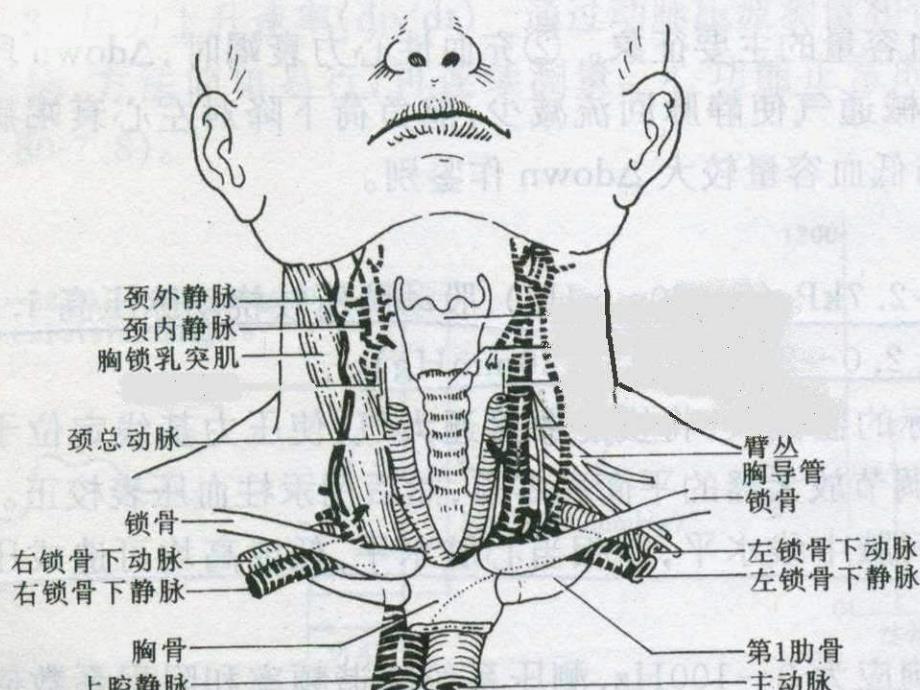 锁骨下静脉径路的技巧.ppt_第4页