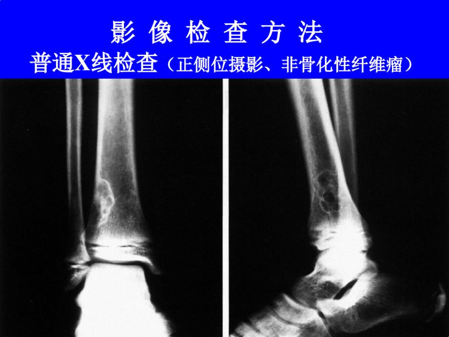 骨关节系统影像诊断学实习片库_第3页