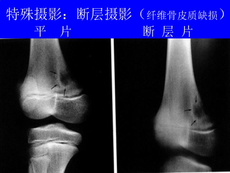 骨关节系统影像诊断学实习片库_第4页