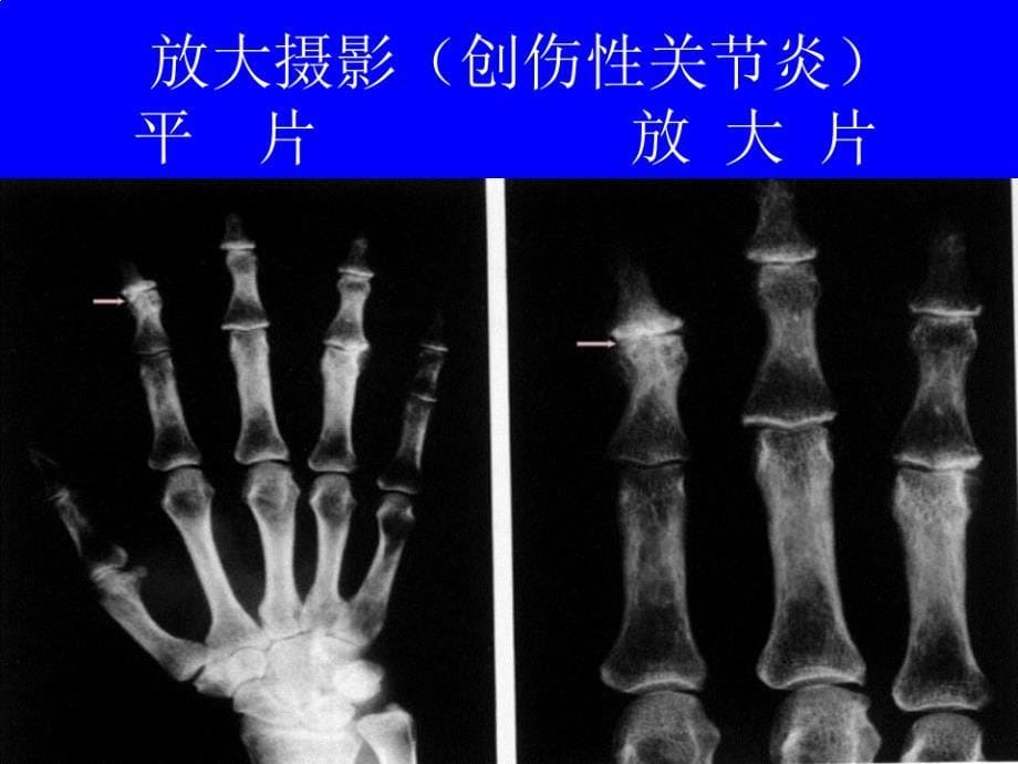 骨关节系统影像诊断学实习片库_第5页