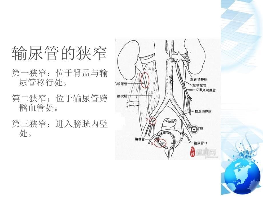 泌尿系结石及护理_第5页