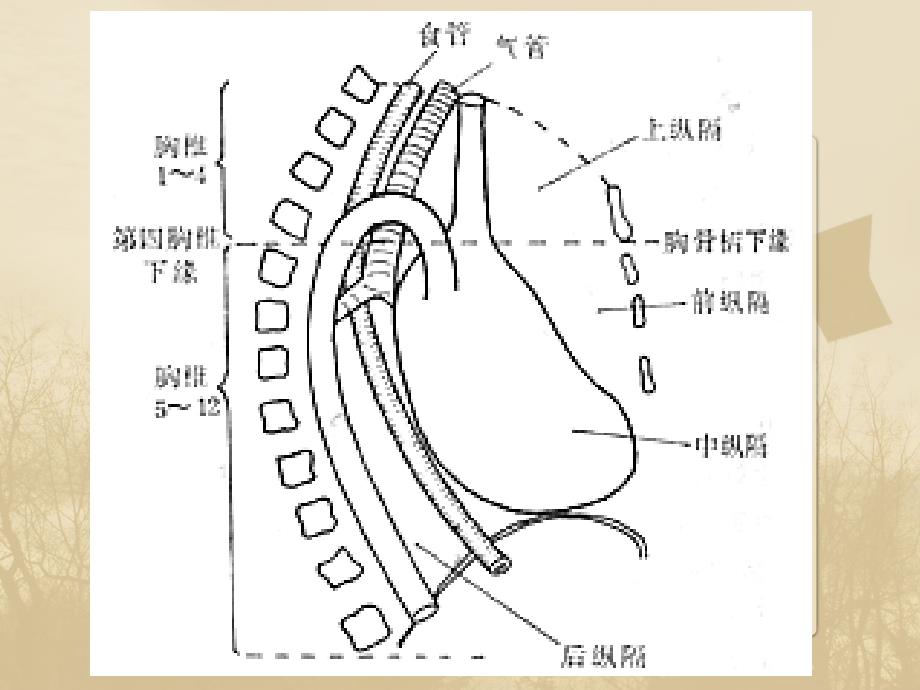 纵隔病变PPT课件_第3页