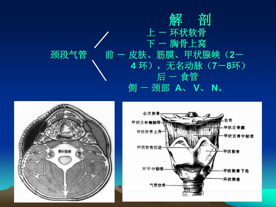 经皮式气管切开术.ppt_第3页