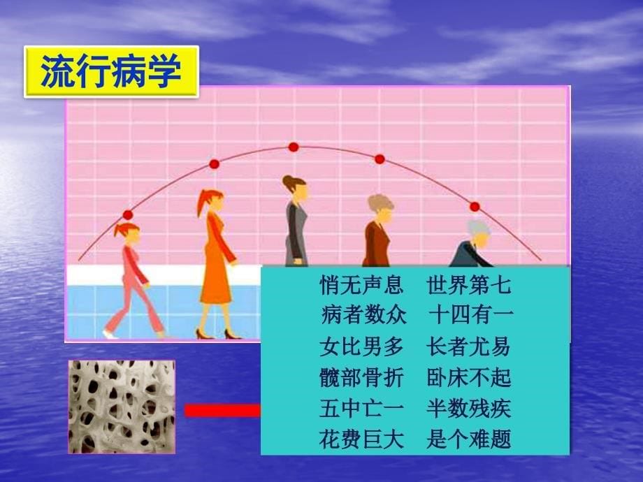 原发性骨质疏松症的诊断 ppt课件_第5页