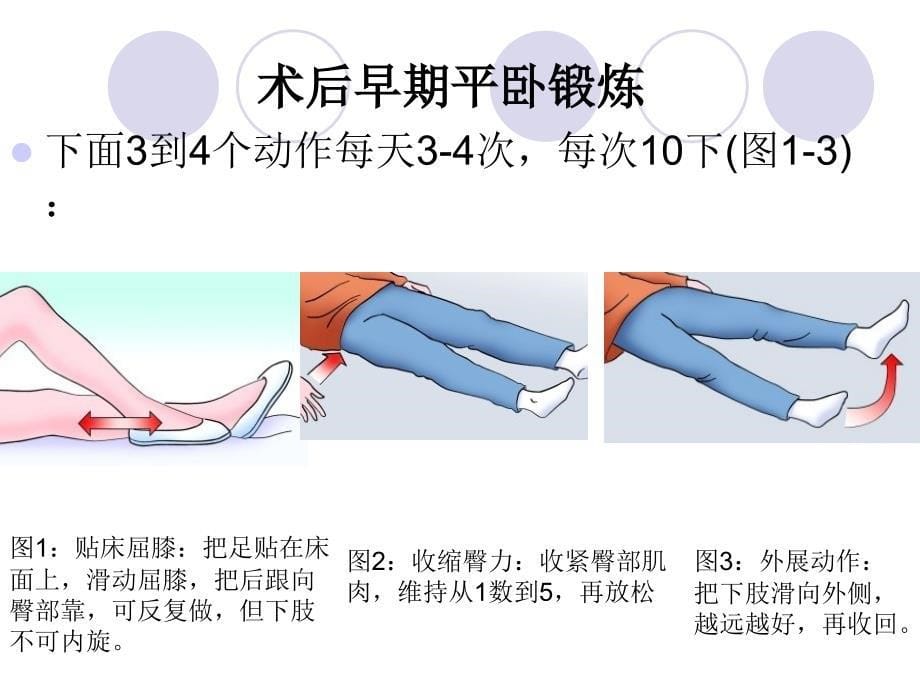 髋关节置换康复训PPT课件_第5页