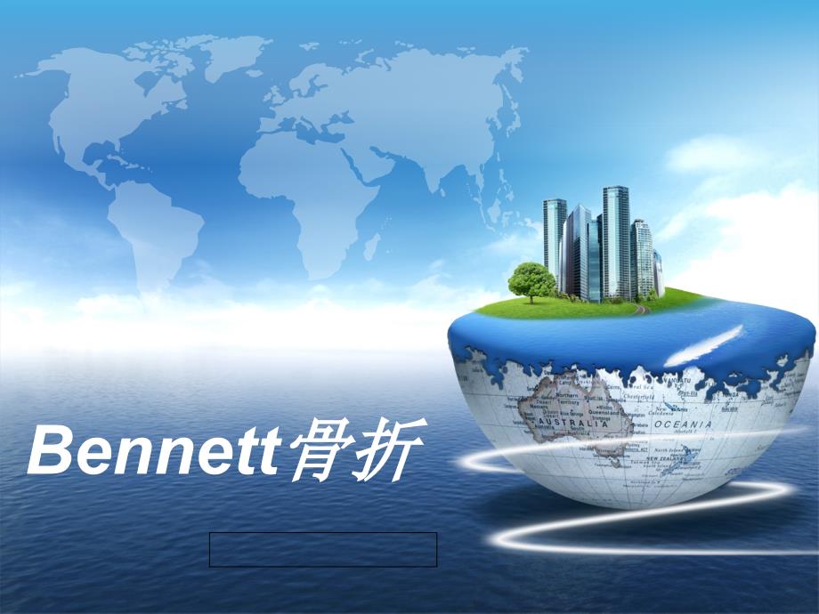 bennett骨折12_第1页