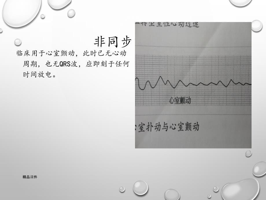 除颤仪操作培训课件_第5页