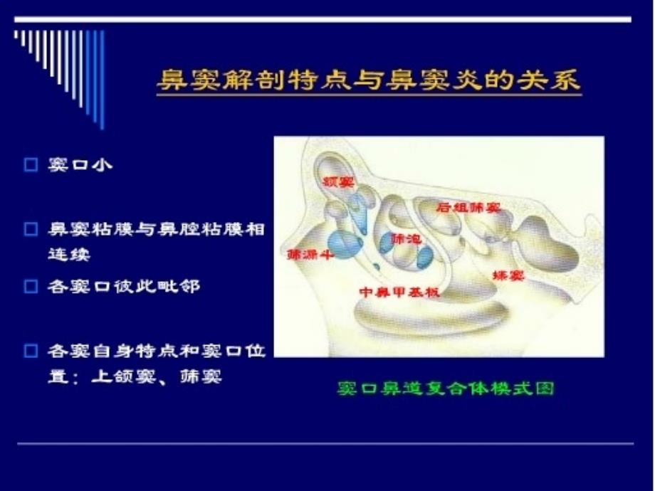 鼻和鼻窦CT解剖经典实用_第2页