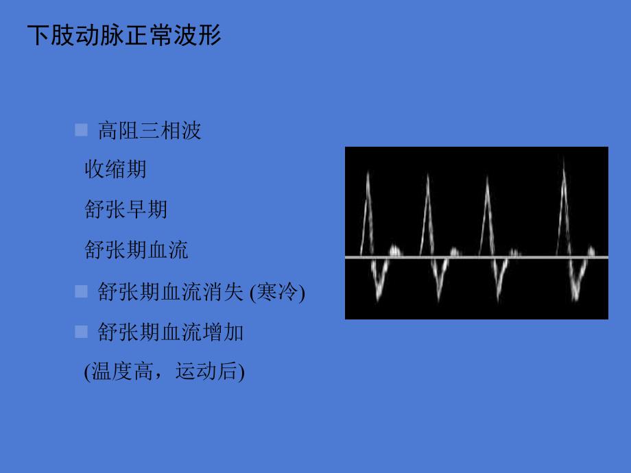 下肢动脉疾病术前后超声诊断课件文档资料_第2页