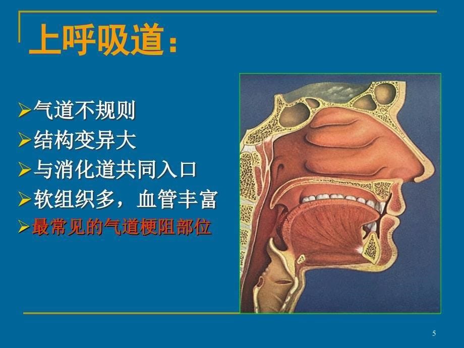 人工气道的建立和维护小讲课ppt课件_第5页